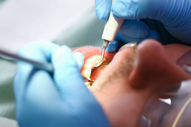 Best Weekend Emergency Dentist in Wellston, MO